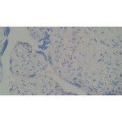 Control Slide, spirochete